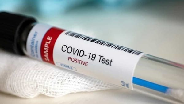 Coronavirus, in Sicilia 102 nuovi casi: 62 i contagiati a Palermo, 12 a Catania