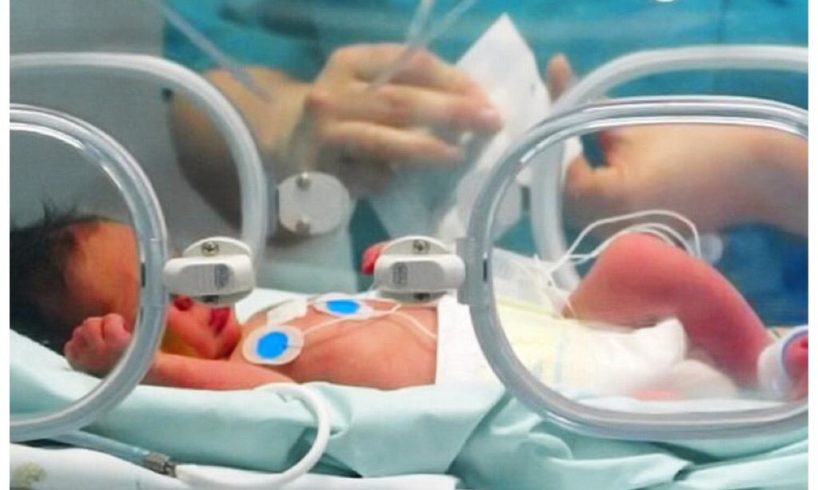 Bronte, bambina con rara malformazione trasferita al ‘Bambino Gesù’ di Roma: grazie all’intervento dell’ospedale Garibaldi