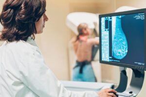 Biancavilla, domani screening mammografico gratuito presso la ‘Radiologia”: iniziativa dell’Apca di Adrano